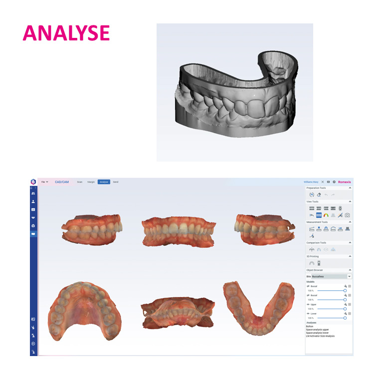 Analyse - Module CAD/CAM Romexis 6.4